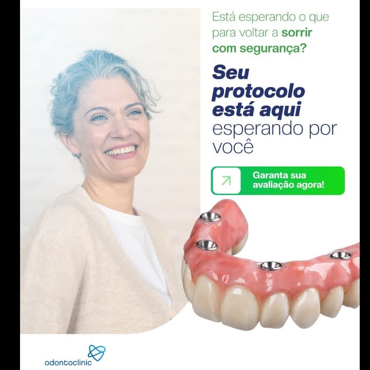 Depois — Resultado real